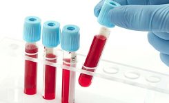 Blood Test to Detect 8 Cancers Before Symptoms Appear